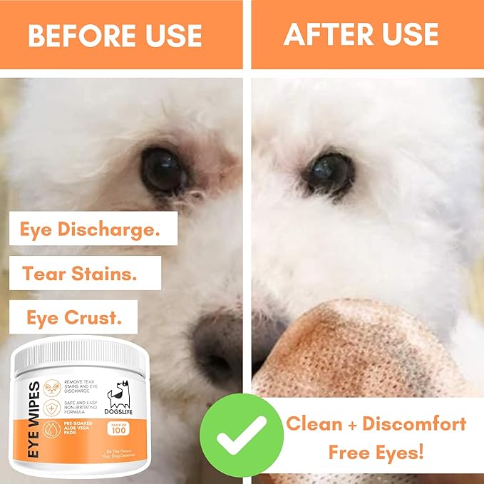 Dog Eye Wipes – Tear Stain Remover for Dogs & Puppies – 100 Aloe Vera Pet Eye Wipes – Gentle Eye Discharge & Crust Cleaner – Safe & Hypoallergenic Dog Eye Cleaning Pads