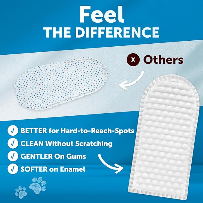 Dog Teeth Cleaning Wipes - 50 Dog Dental Care Finger Wipes - Finger Toothbrush for Removing Plaque, Tartar Buildup, Bad Breath - Oral Freshness, Healthy Teeth & Gum Support with Coconut Oil, Unscented